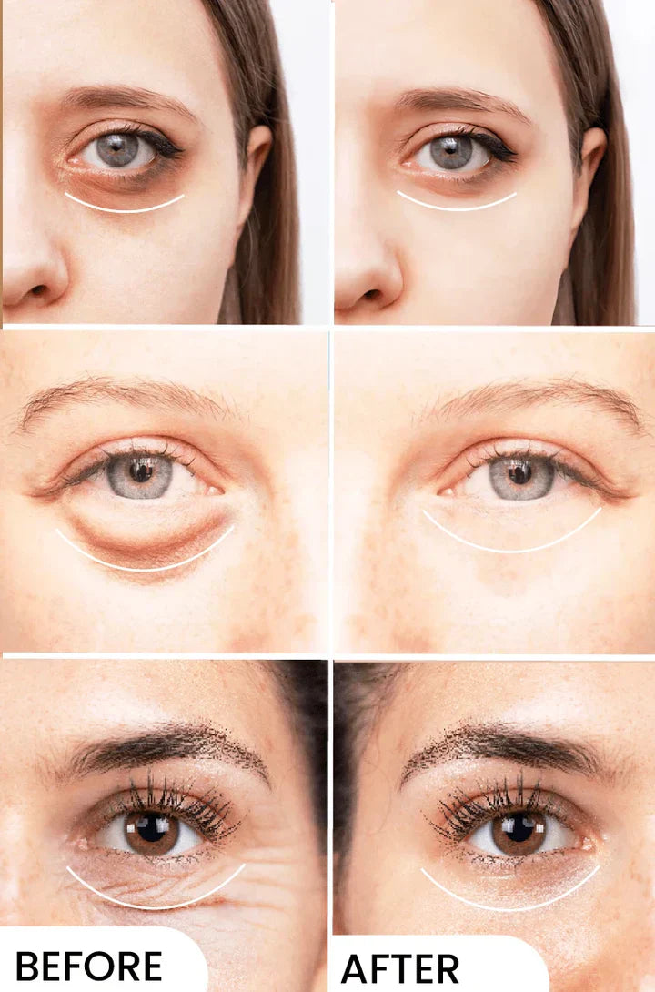 Eyelight Eye Serum - Eliminates Dark Circles & Puffy Eyes - Classy Pk
